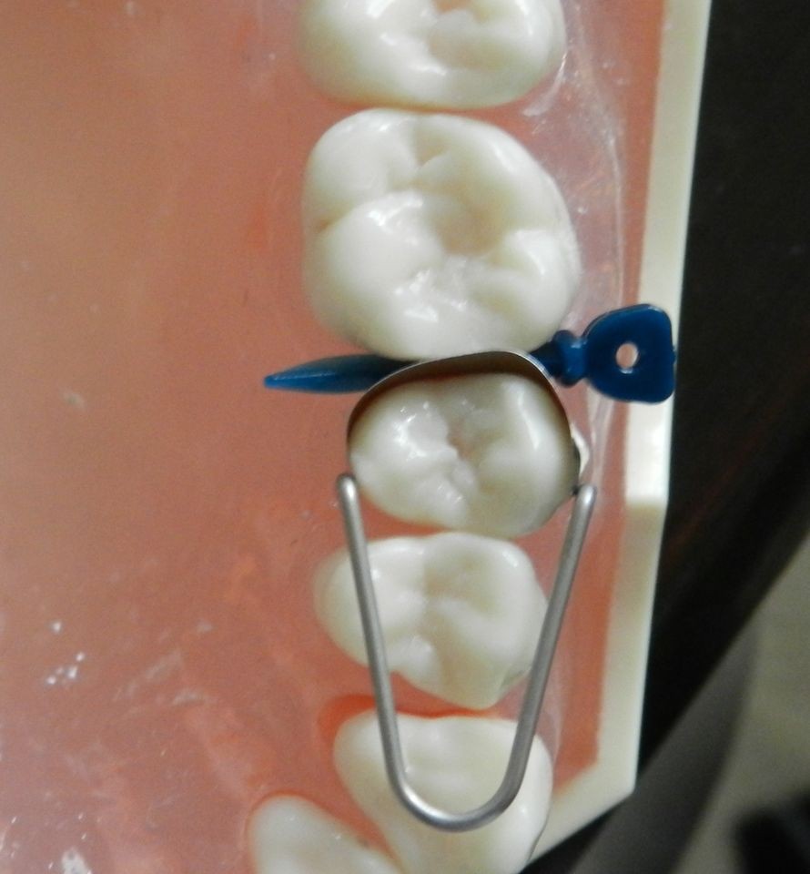 DENTAL MATRIX BANDS / COMPOSITE / AMALGAM/GREAT CONTACT